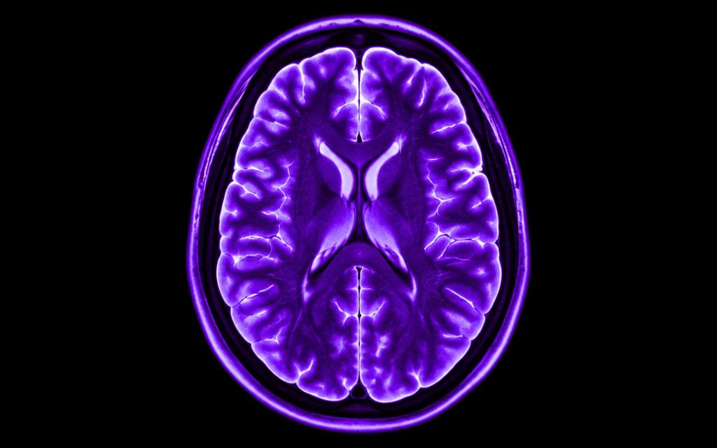 Illustrated brain scan